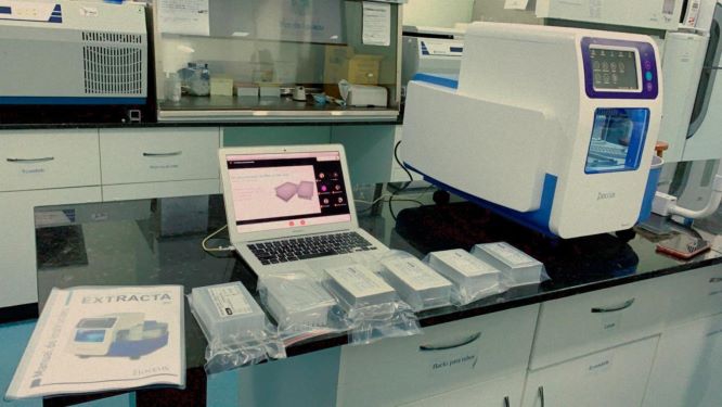 O novo equipamento, com custo de R$ 293 mil. Foto: PMFI