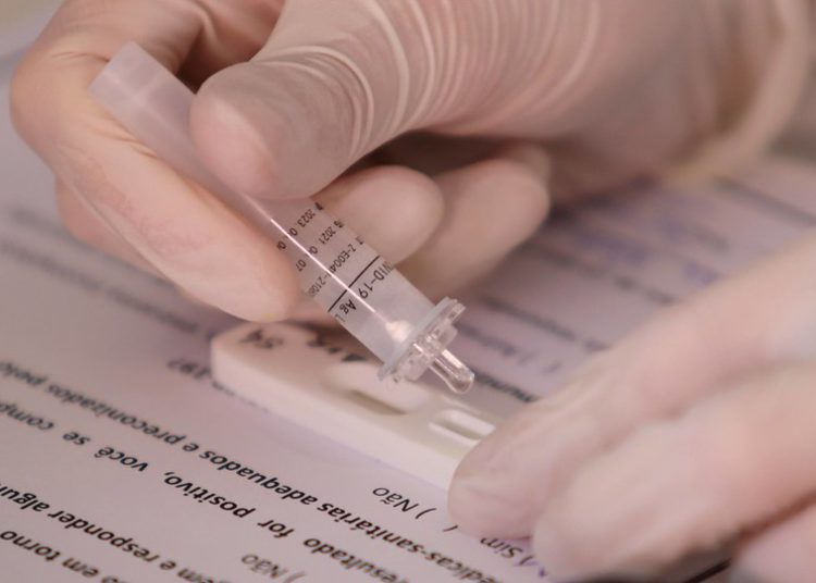 Teste de Covid-19. Foto ilustrativa: PMFI/Divulgação