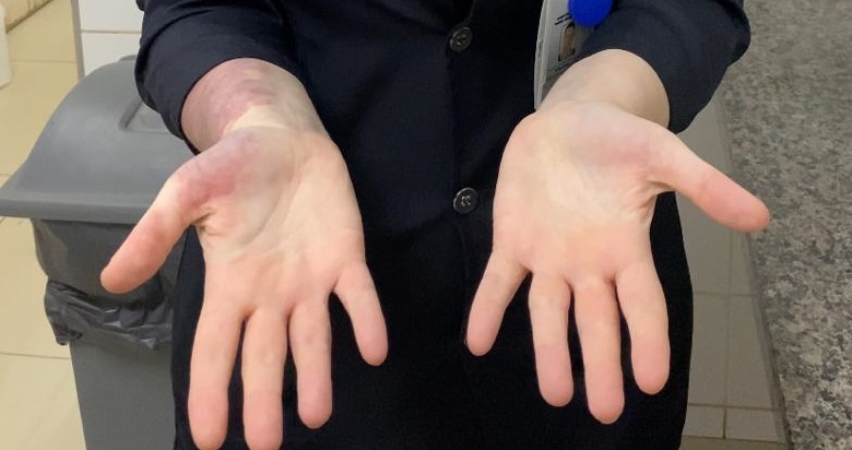 Foto ilustrativa: PMFI